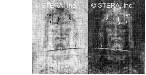 The Shroud Of Turin